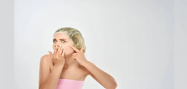 بثور عميقة حول الفك والذقن نتيجة حب الشباب أثناء الدورة الشهرية.