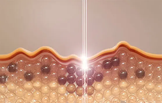 آلية عمل حاجز البشرة السليم (الطوب والملاط) في الحفاظ على الرطوبة.